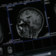 Illustration for article titled This Siemens MRI Scanner Is a Beautiful Machine That Saves Lives